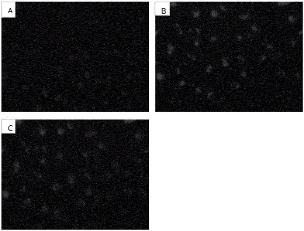 Method for isolating and culturing endothelium from human adipose tissue for clone formation of cells