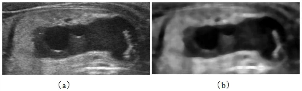 Thyroid gland detection device