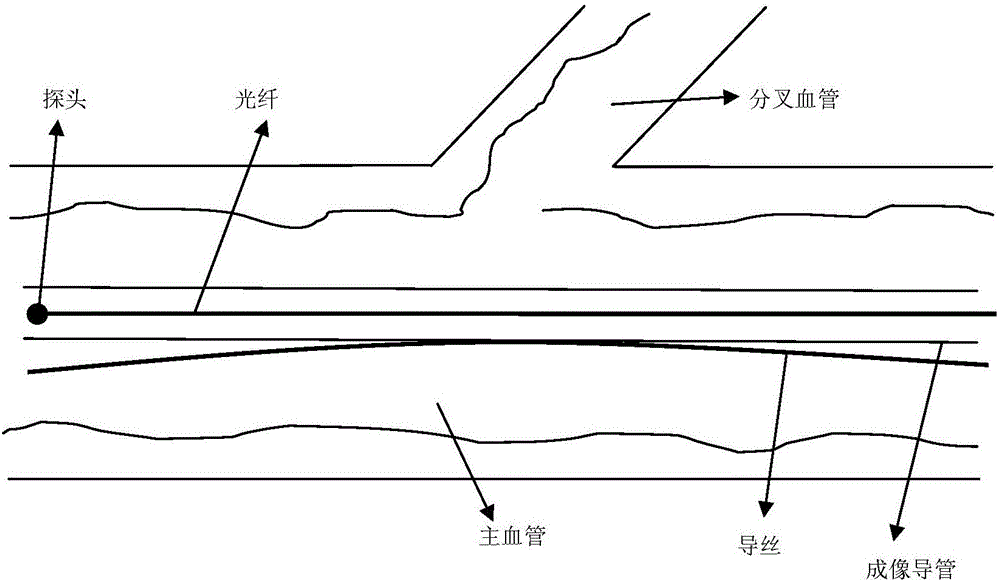 Stent-implantation pre-operation analysis system and method based on OCT
