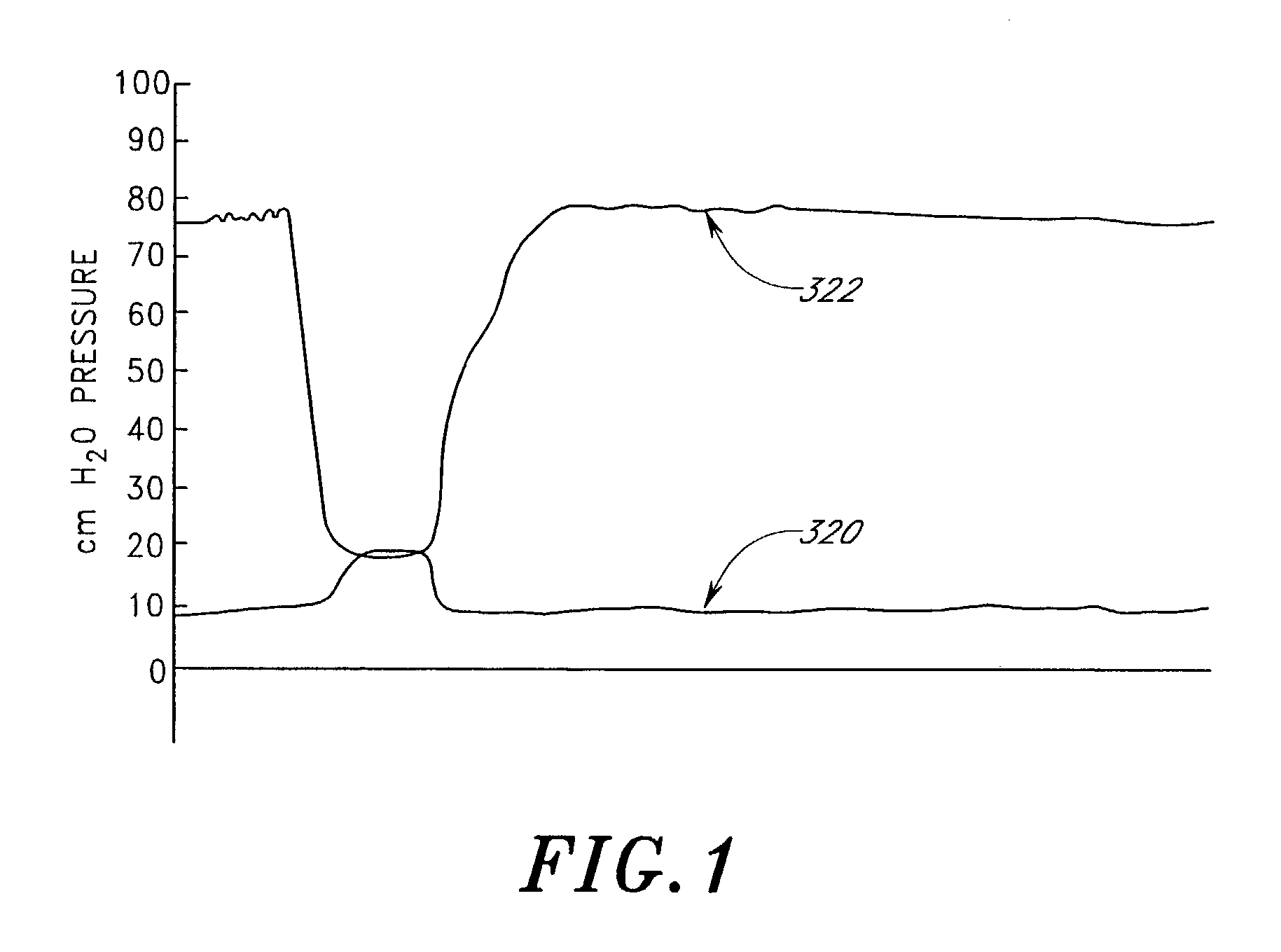 Treatment of patients with a compressible attenuation device