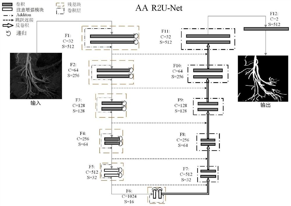 CT abdominal artery blood vessel grading recognition method based on deep learning