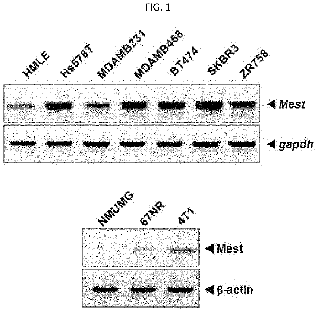 Mest as biomarker for cancer diagnosis and prognosis and method for using thereof