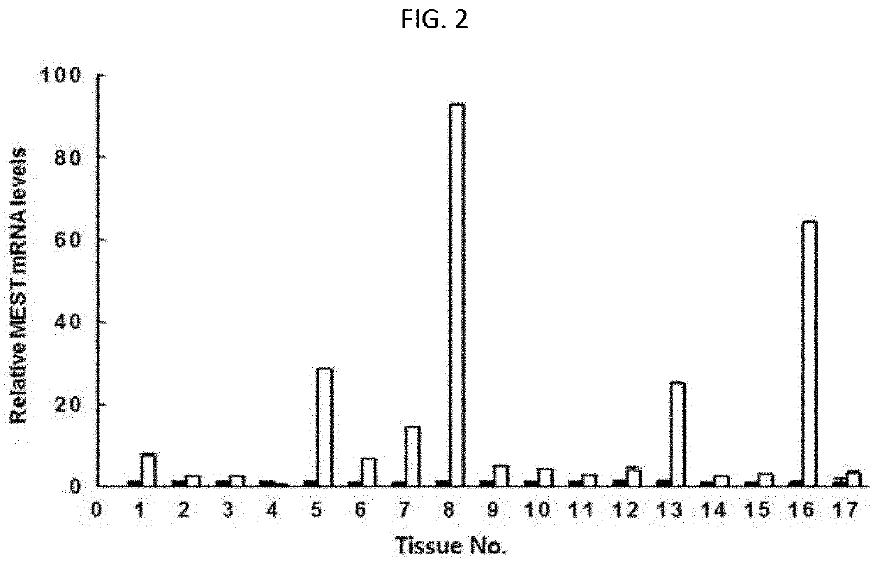 Mest as biomarker for cancer diagnosis and prognosis and method for using thereof