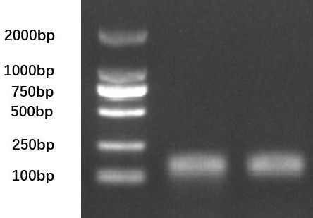 SNP (Single Nucleotide Polymorphism) molecular marker related to muscle drip loss character of meat rabbit and application of SNP molecular marker