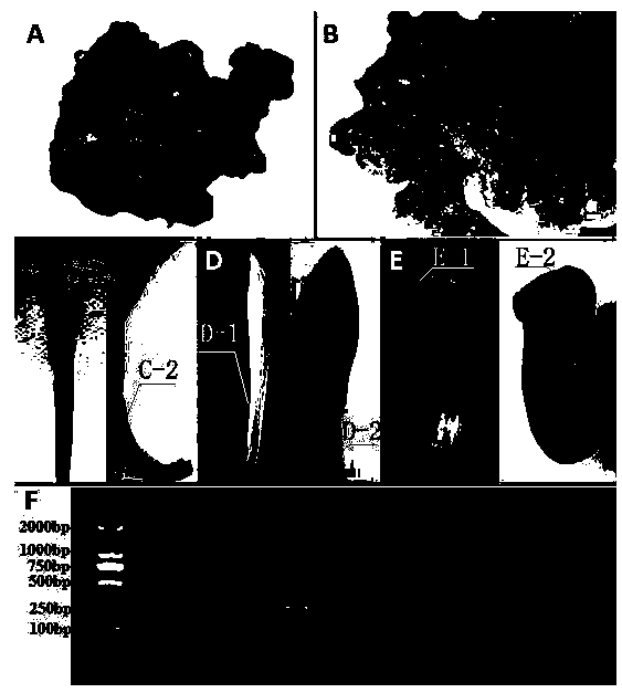 A high-efficiency genetic transformation system for Lilium microphylla based on somatic embryogenesis