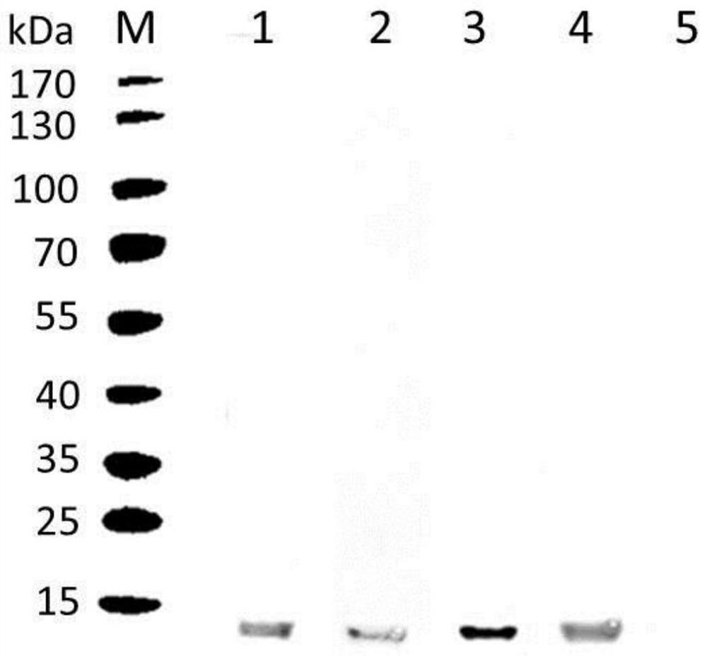 Genes highly expressed in schistosomula japonicum katsurada as well as encoded proteins and application thereof