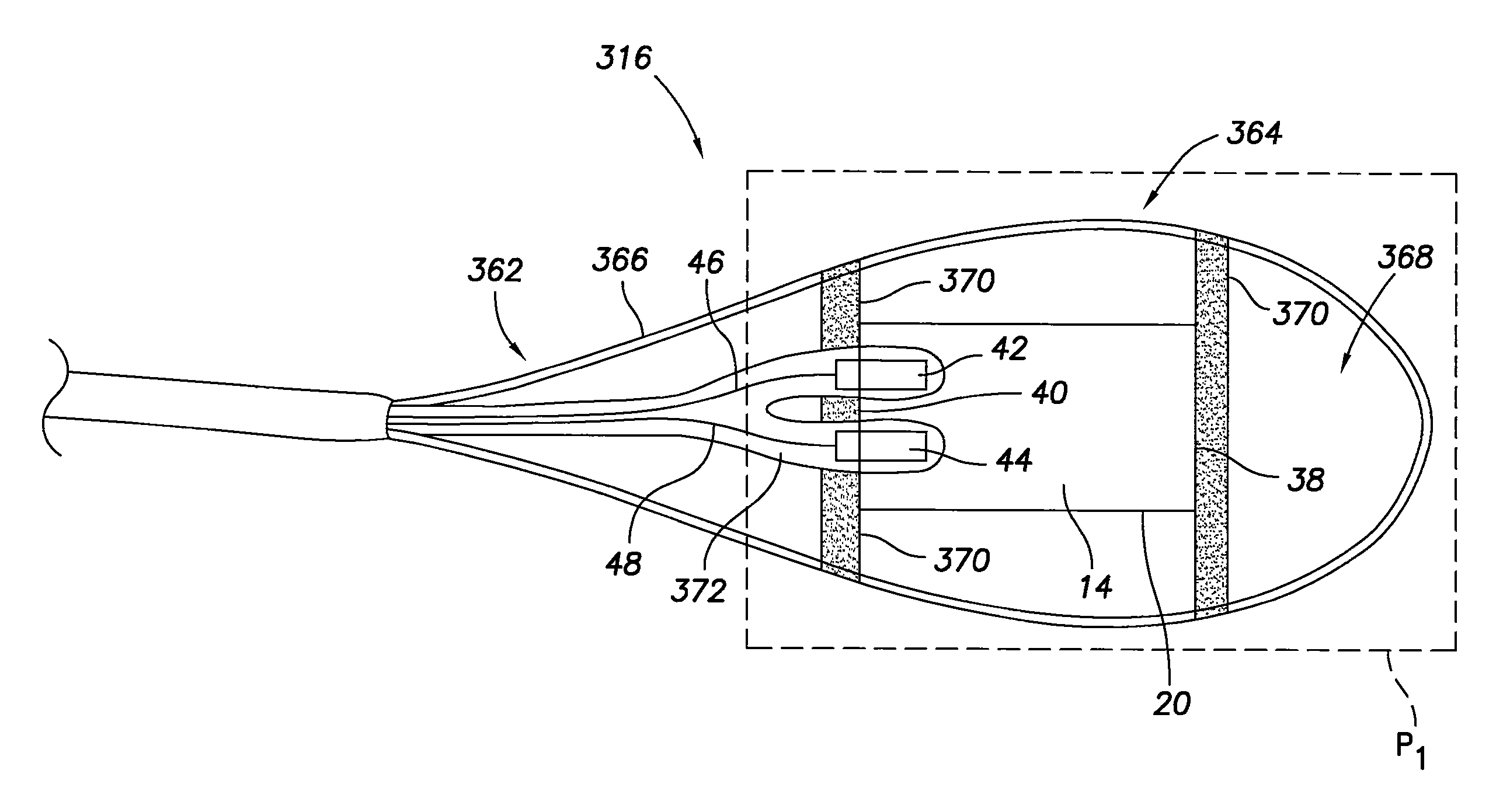 Implantable sensor for measuring physiologic information