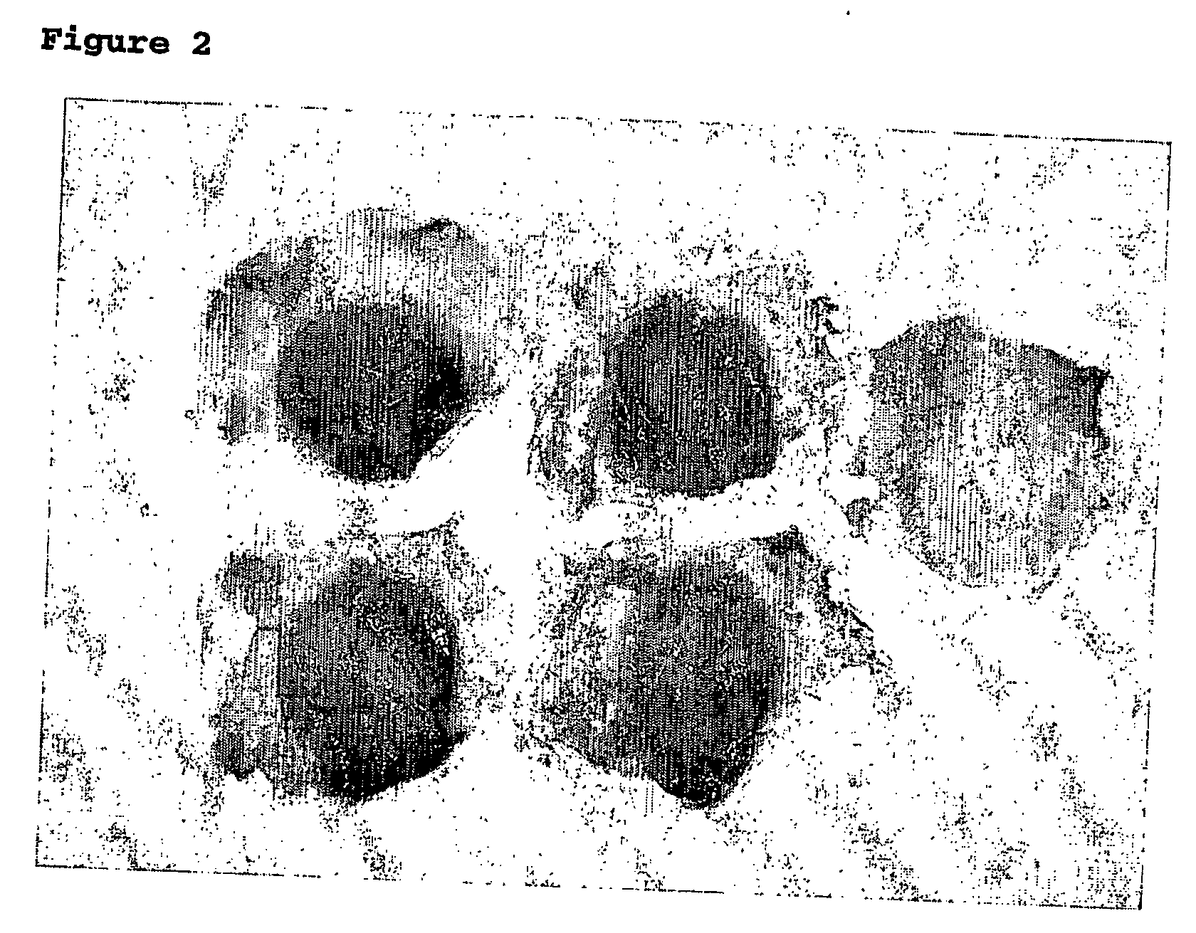 Method of treatment of systemic injury secondary to burns