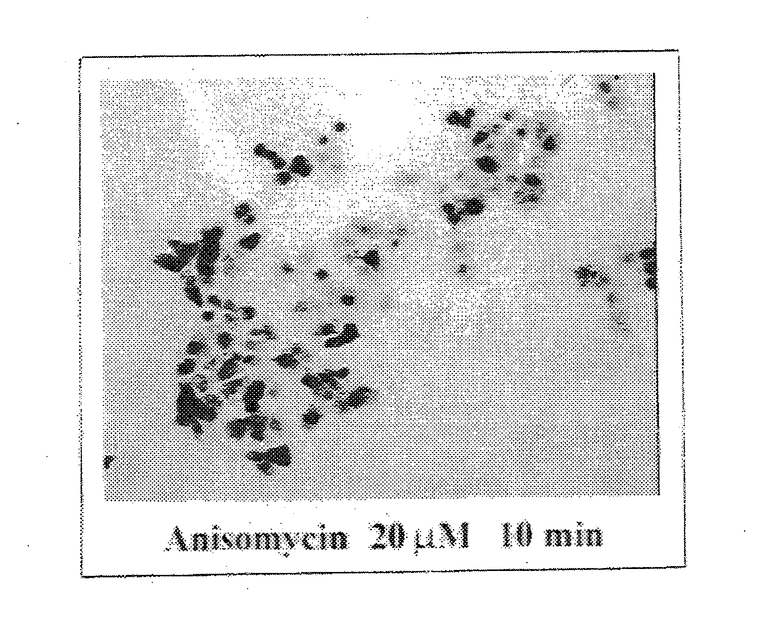 Modulation of the Phospholipase A2 Pathway as a Therapeutic