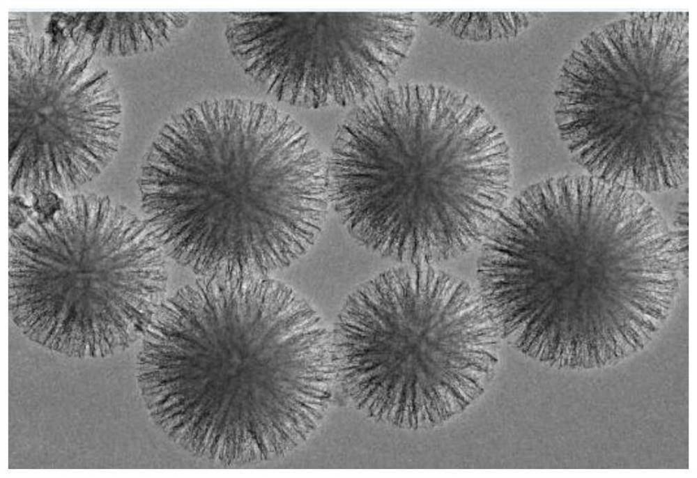 A dendritic porous sio  <sub>2</sub> Base Composite Resin and Its Preparation and Application