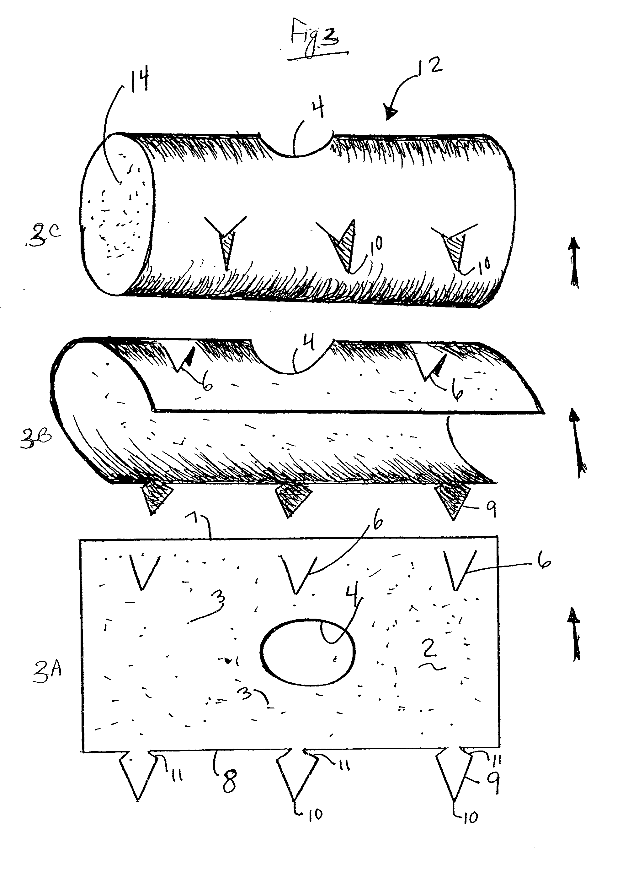 Apparatus and methods for preventing or treating failure of hemodialysis vascular access and other vascular grafts