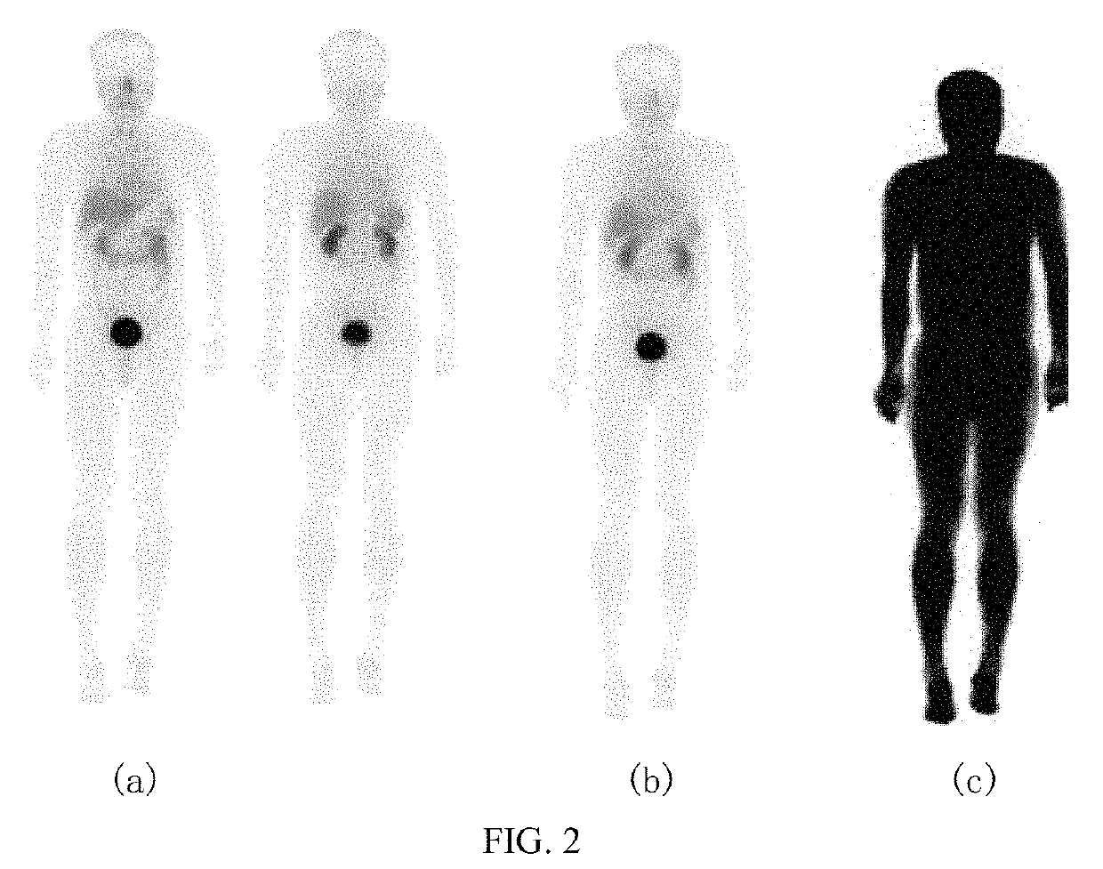 Method and system for calculating SUV normalization coefficient in a SPECT quantitative tomographic image