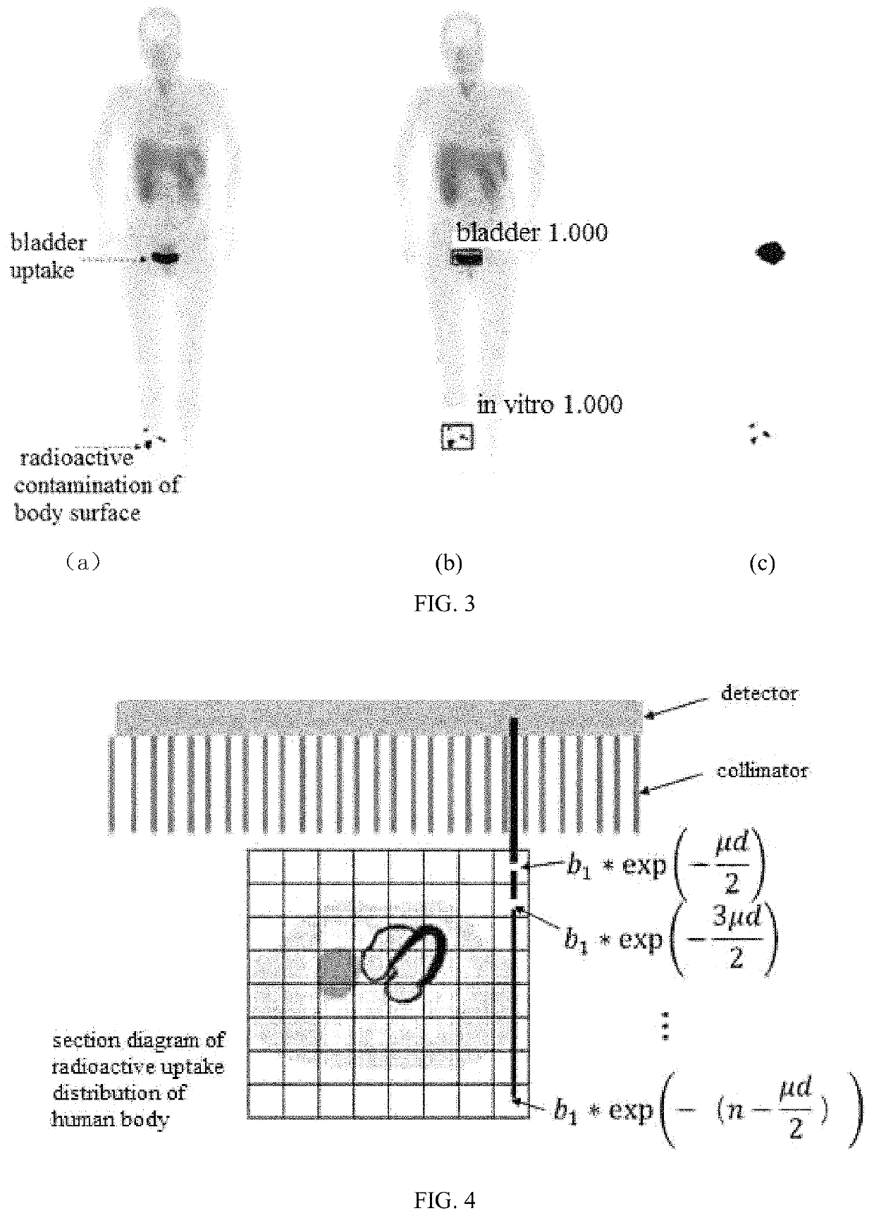 Method and system for calculating SUV normalization coefficient in a SPECT quantitative tomographic image