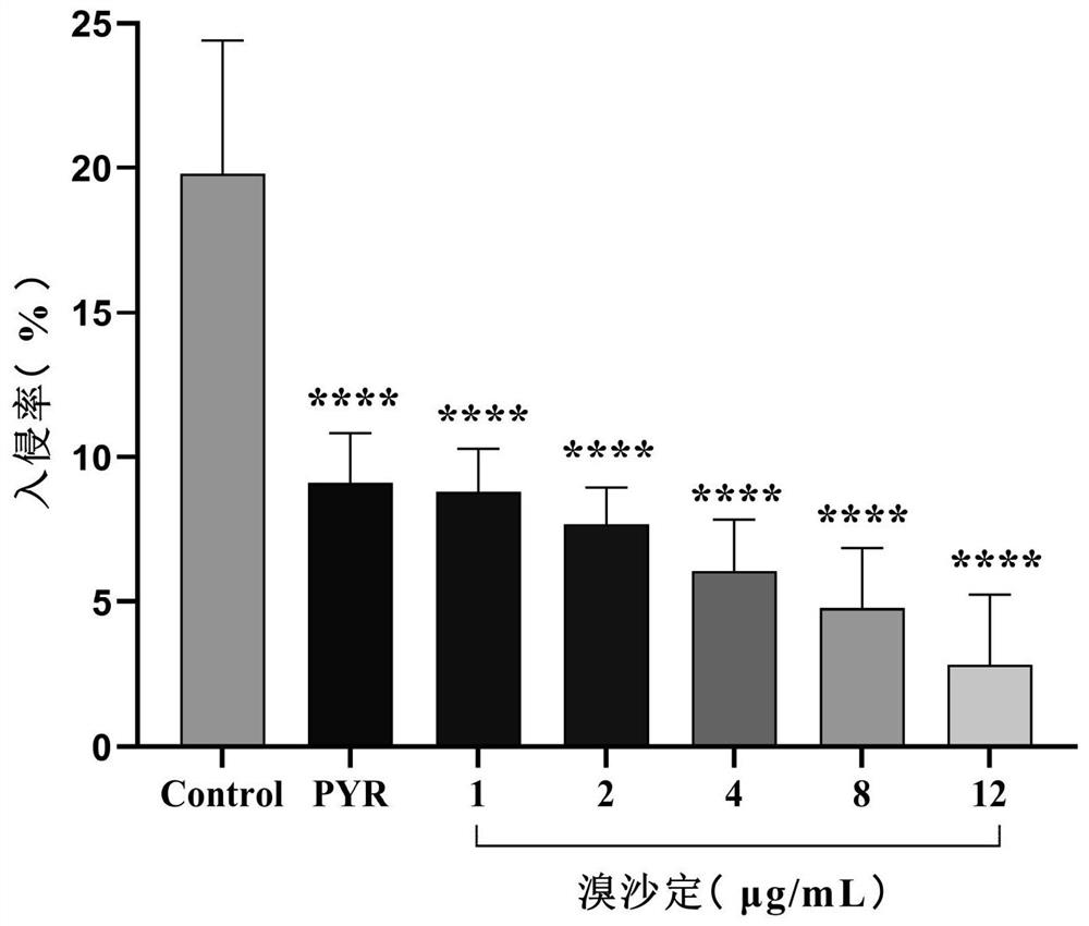 Application of quinoline compound broxaldine in inhibition of toxoplasma gondii activity