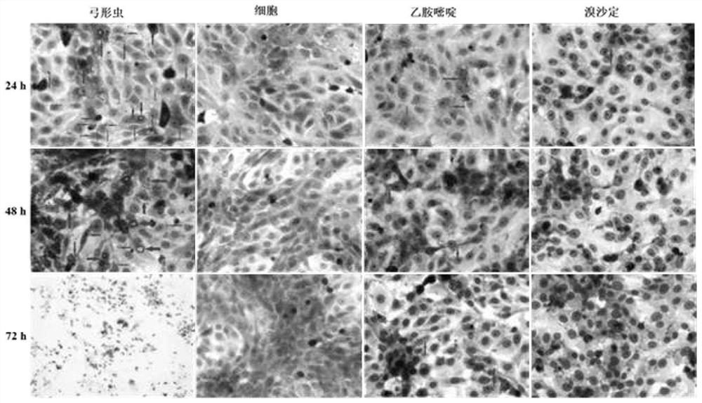 Application of quinoline compound broxaldine in inhibition of toxoplasma gondii activity