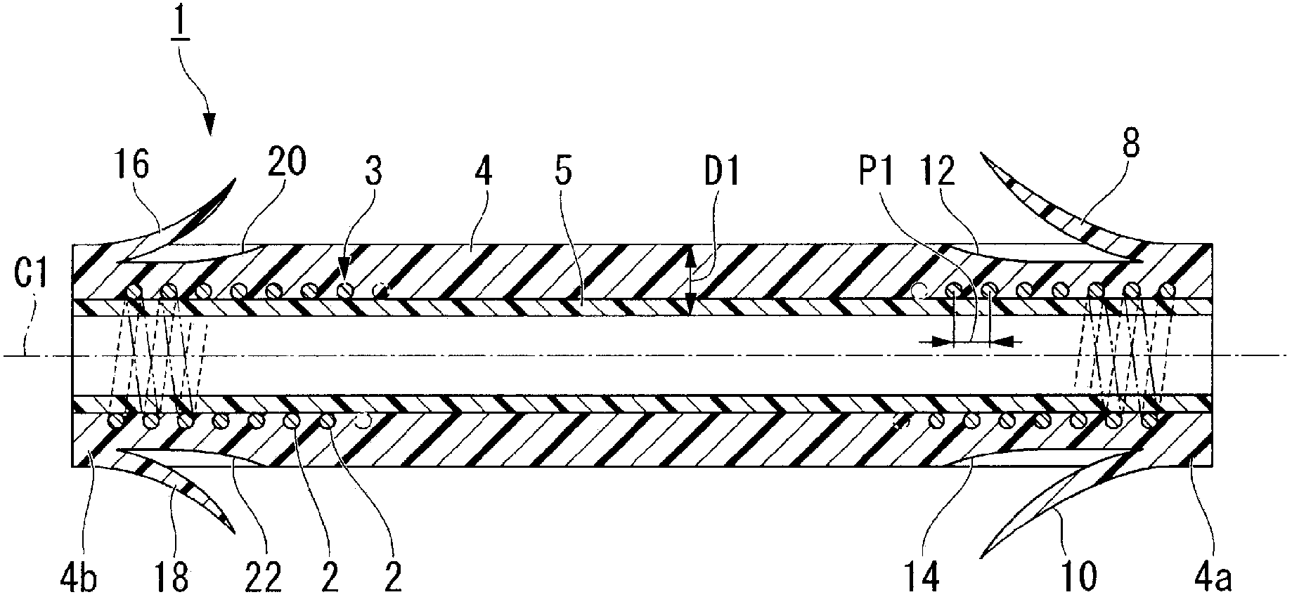 medical stent