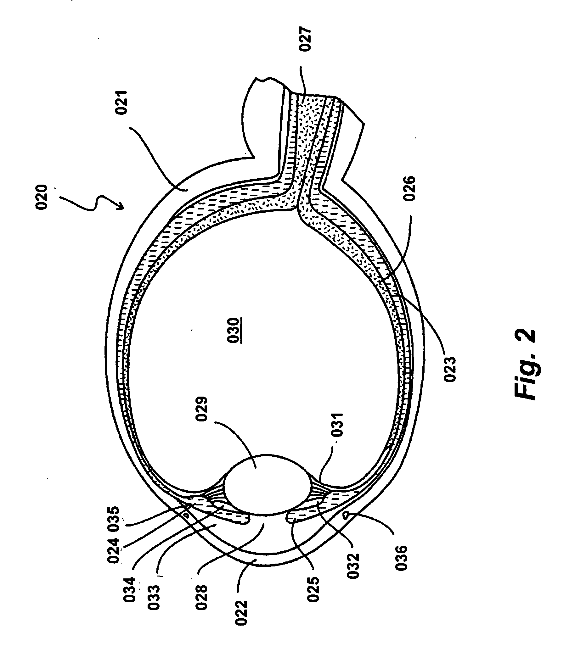Foldable intraocular lens with adaptable haptics