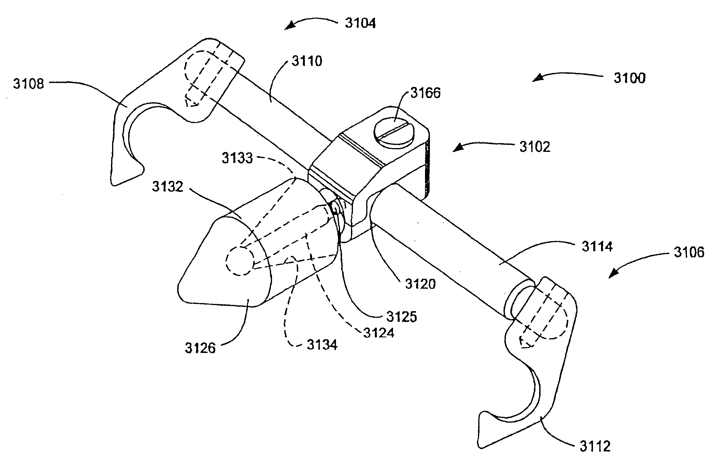 Supplemental spine fixation device and method