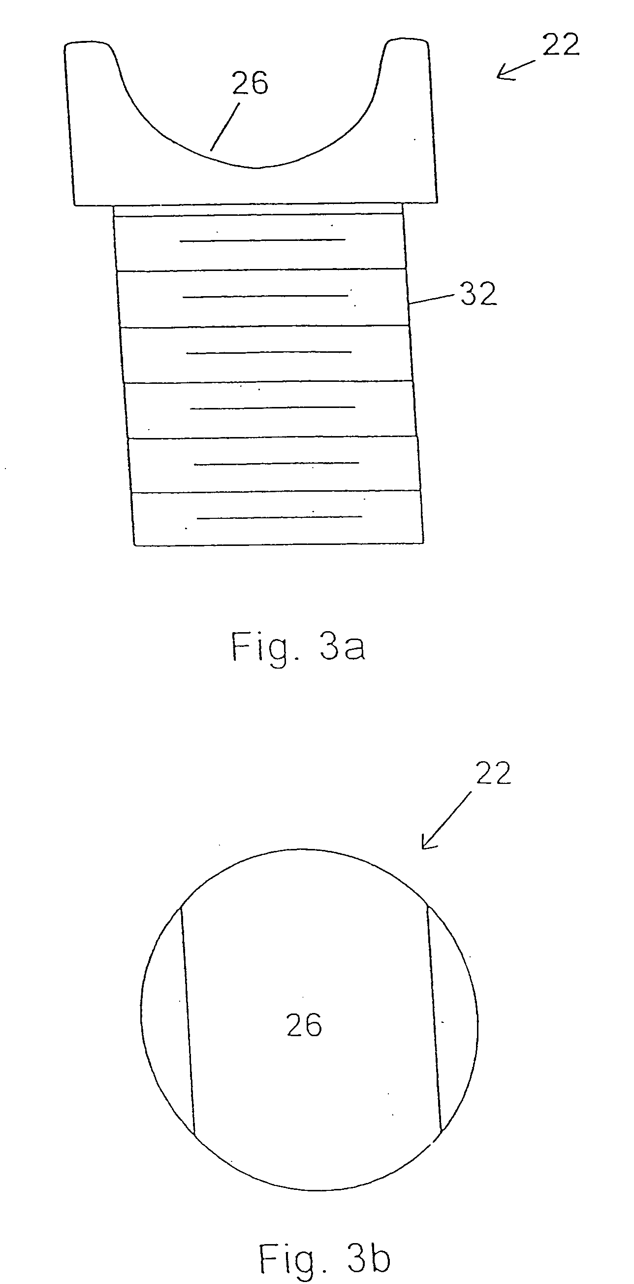 Supplemental spine fixation device and method