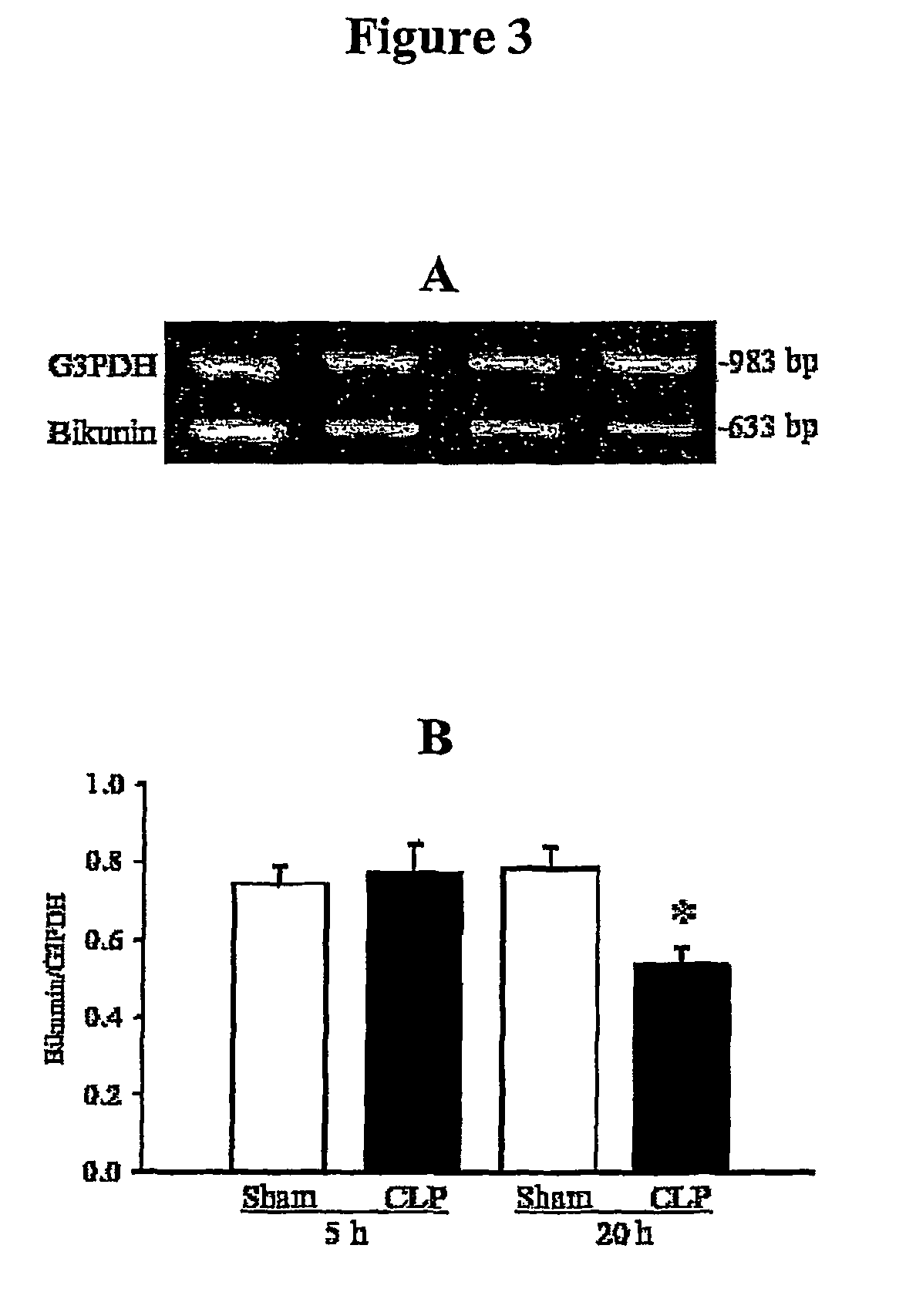 Preparation and composition of inter-alpha inhibitor proteins from human plasma for therapeutic use