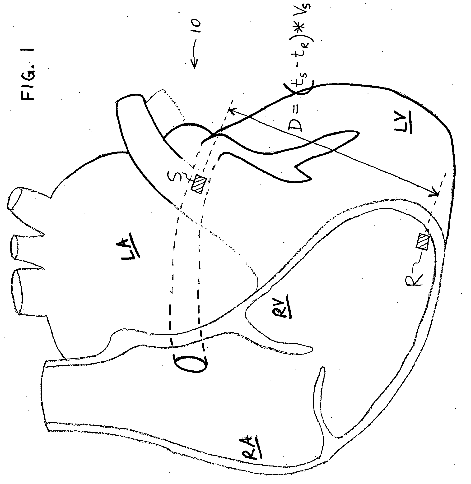 Method and apparatus for evaluating ventricular performance during isovolumic contraction