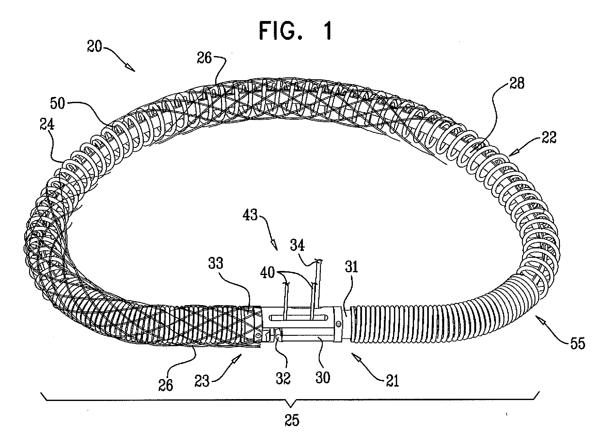 Actively-engageable movement-restriction mechanism for use with an annuloplasty structure