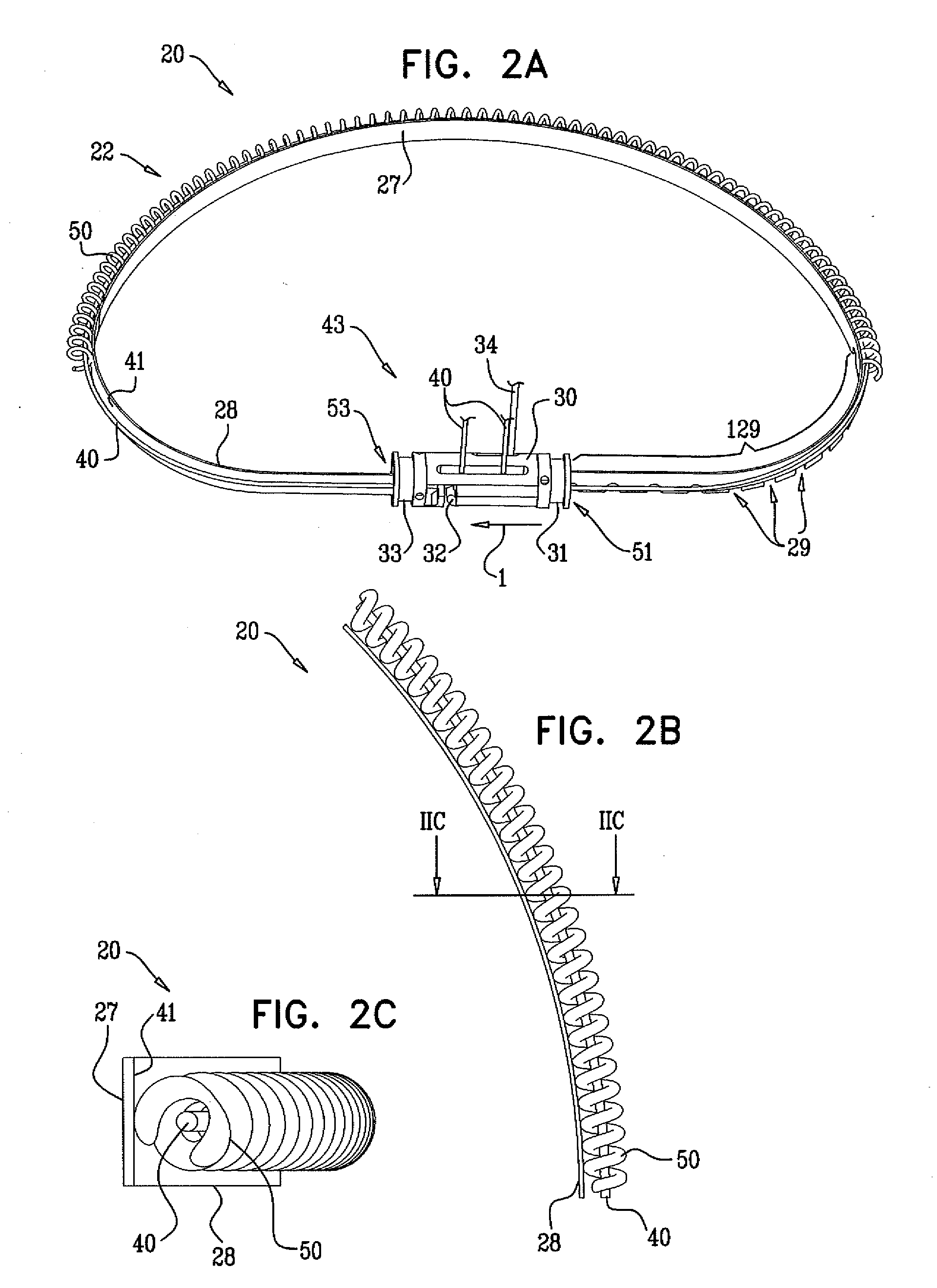 Actively-engageable movement-restriction mechanism for use with an annuloplasty structure