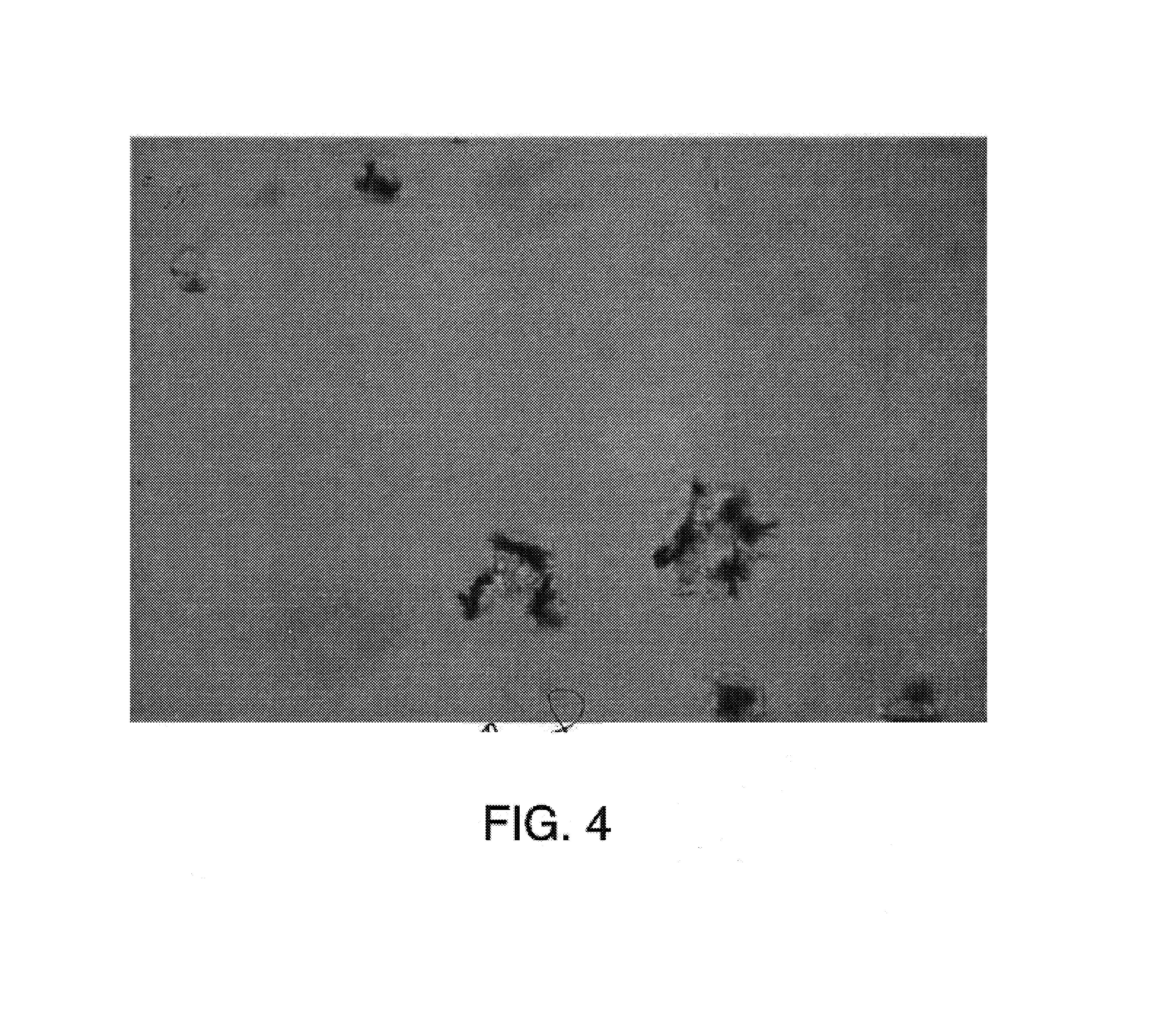 Method and composition for treating cancer using cellular organelle crystallizing agents