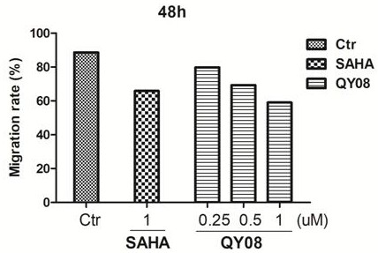 Application and preparation method of gamma-carbolin-hydroxamic acid anti-tumor metastasis compound