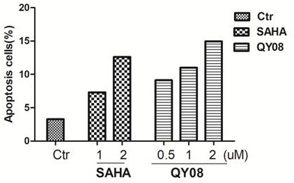 Application and preparation method of gamma-carbolin-hydroxamic acid anti-tumor metastasis compound