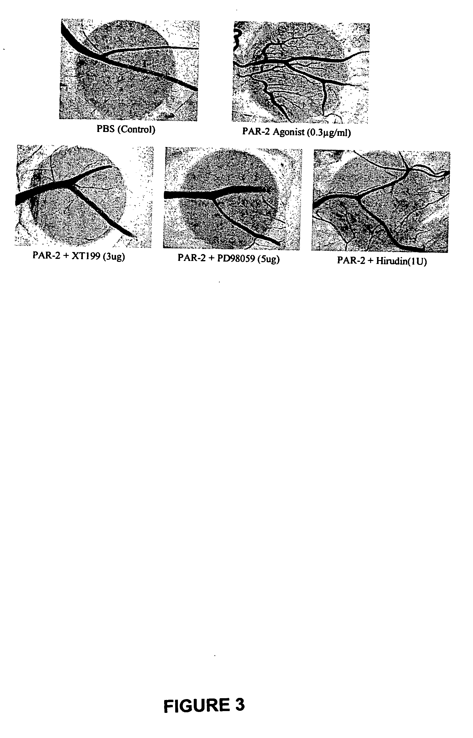 Activators and inhibitors of protease activated receptor2 (PAR2) and methods of use