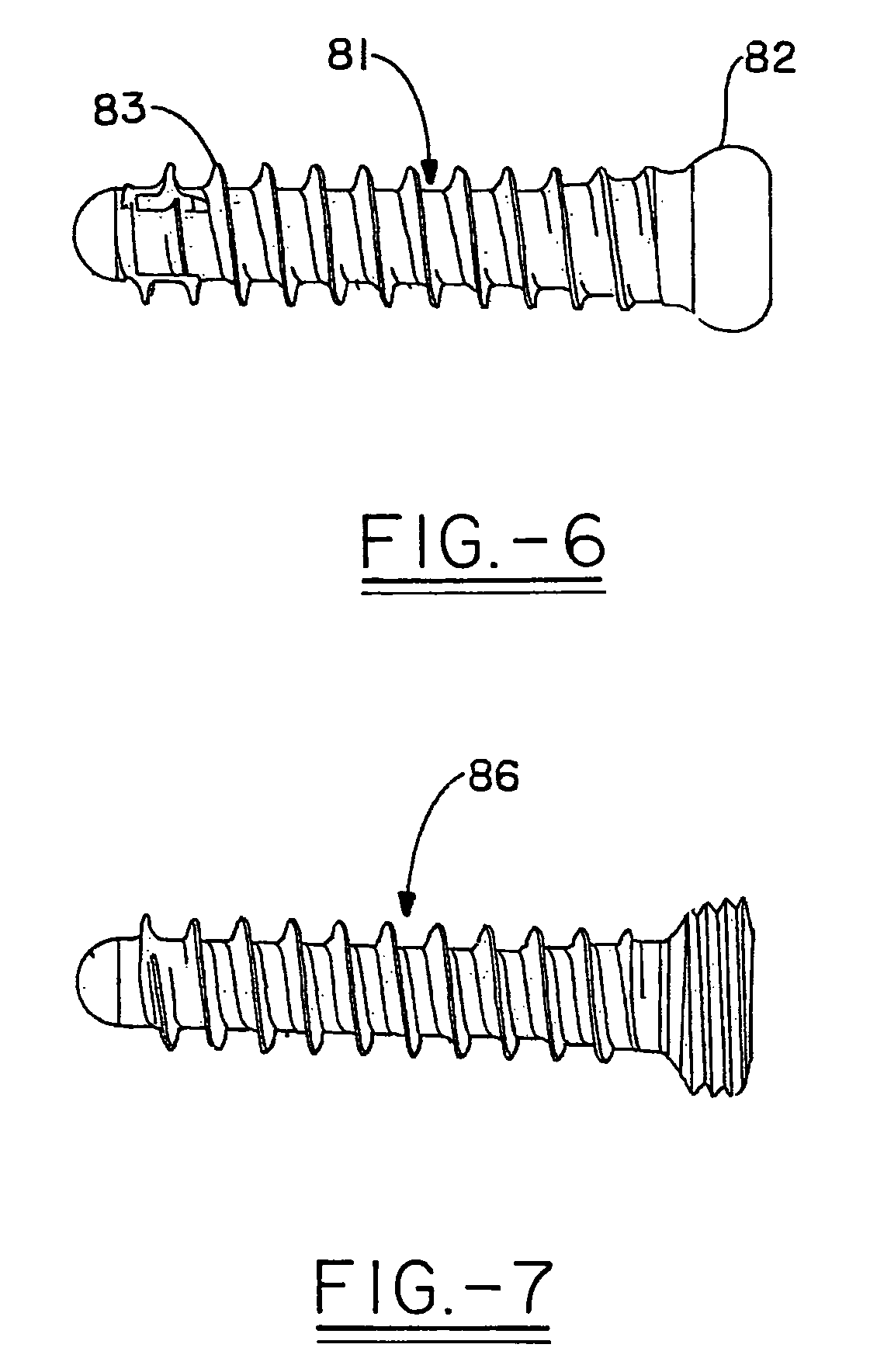 Orthopedic plates for use in clavicle repair and methods for their use