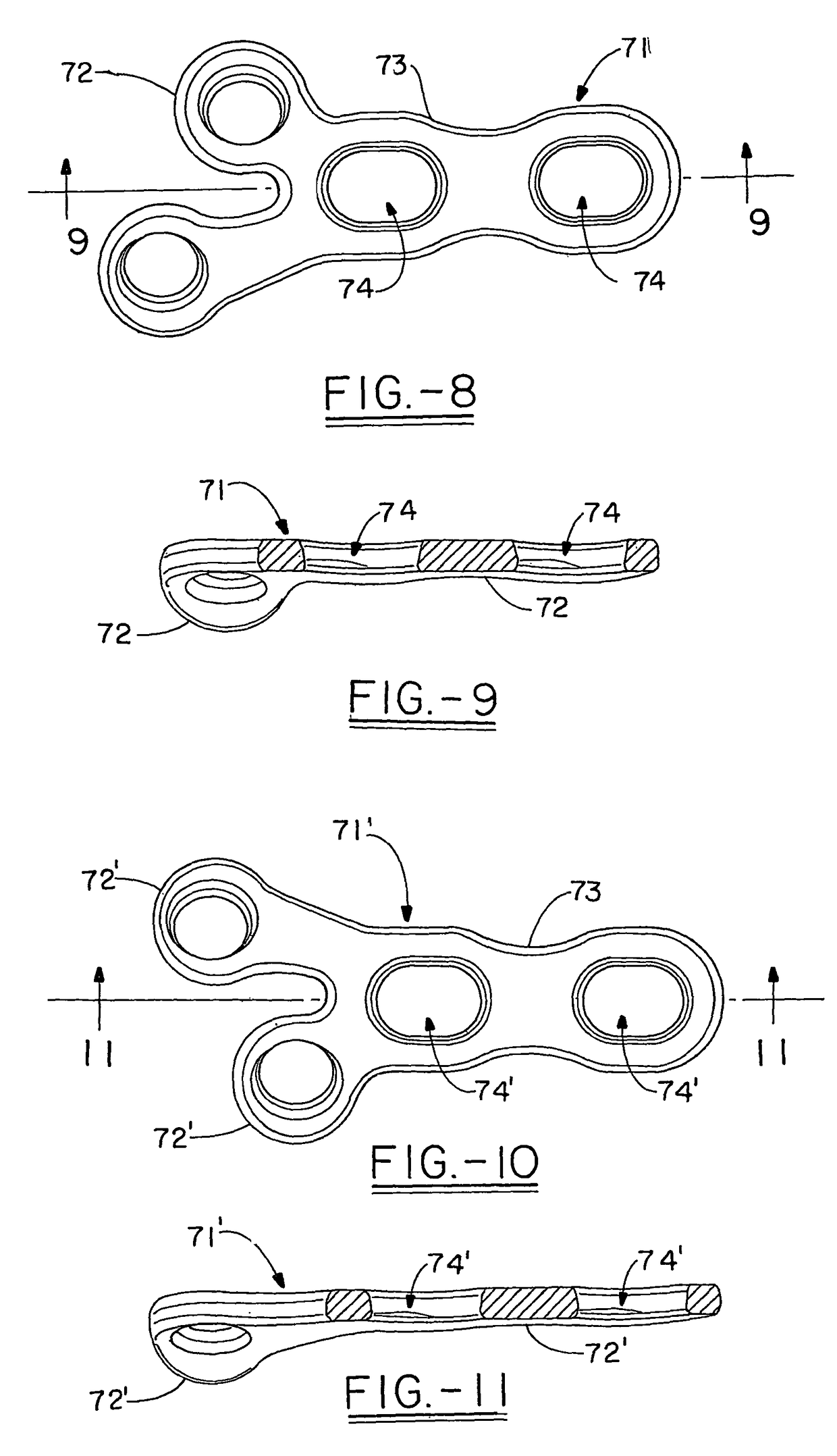 Orthopedic plates for use in clavicle repair and methods for their use