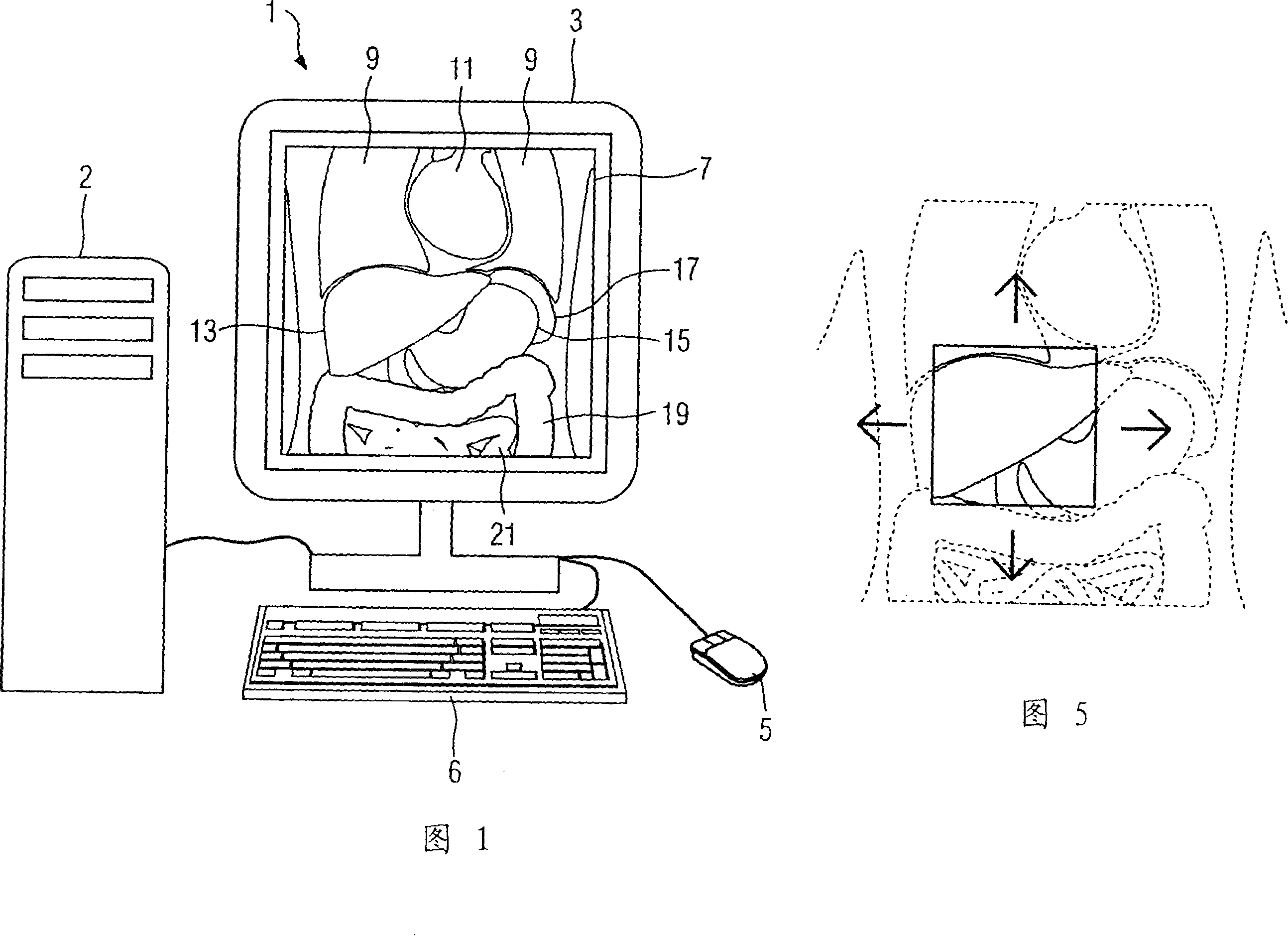 Method for generating a medical image and corresponding data processing unit and computer software