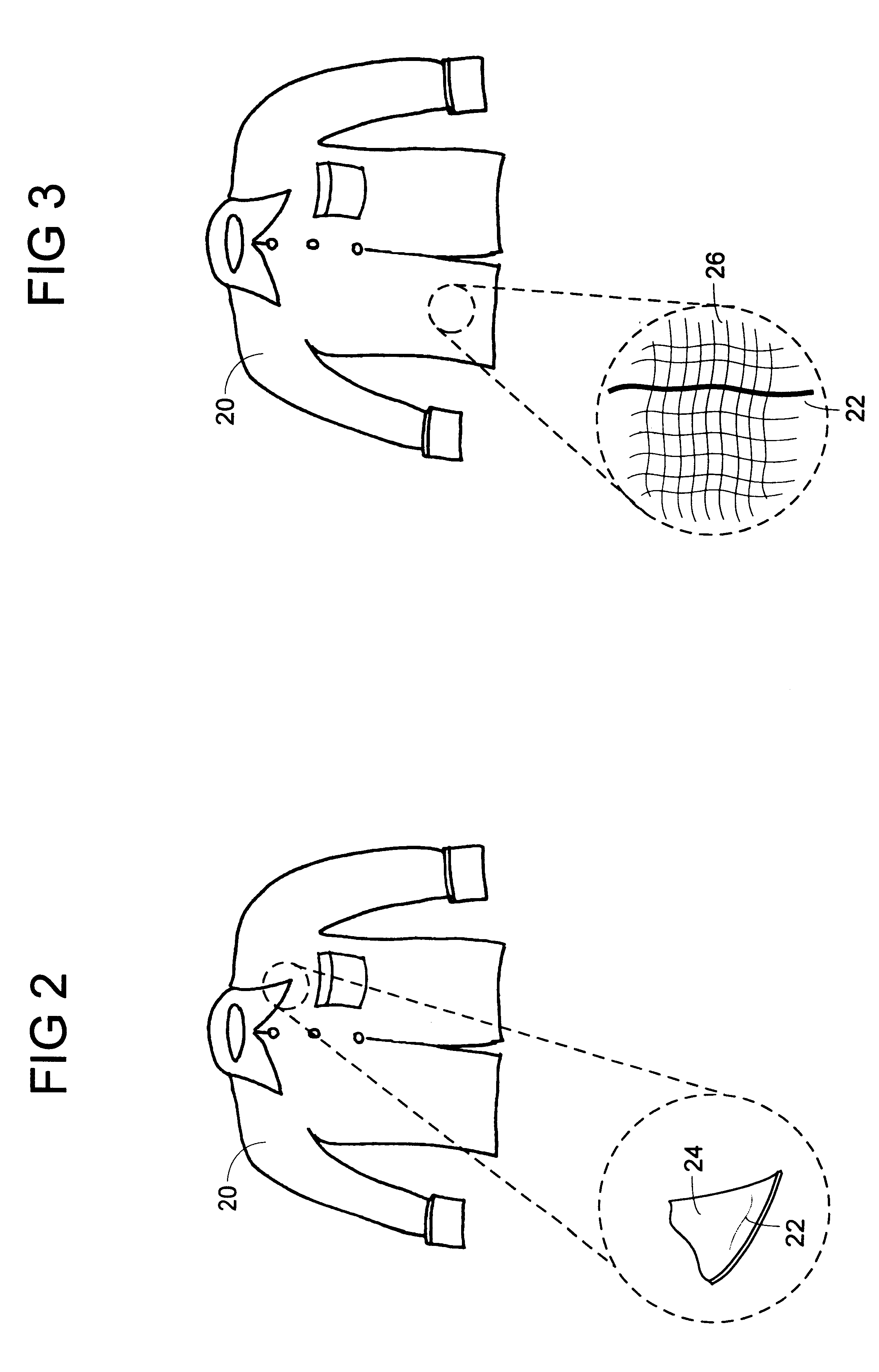 Sensor and method for remote detection of objects