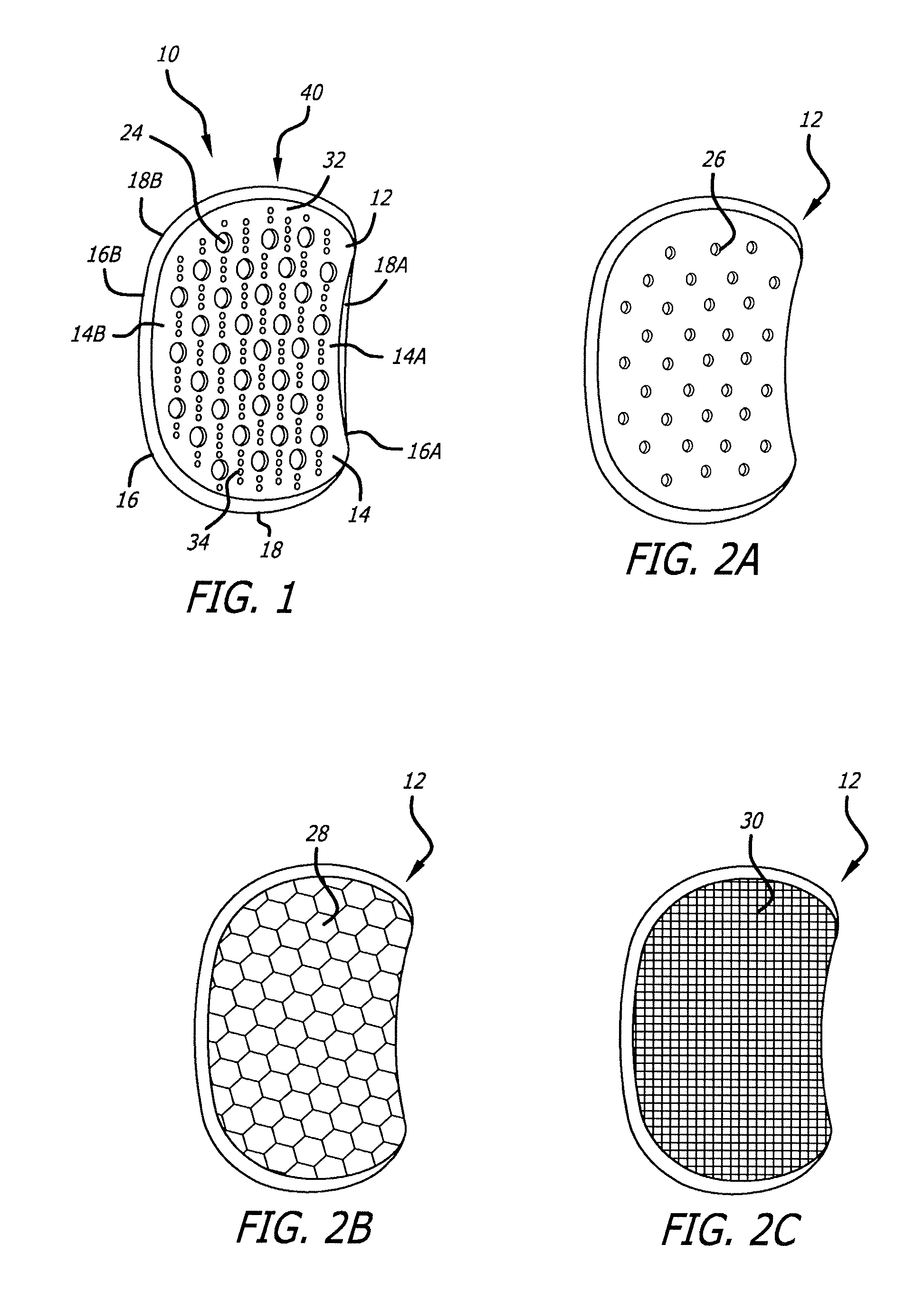 Joint support and subchondral support system