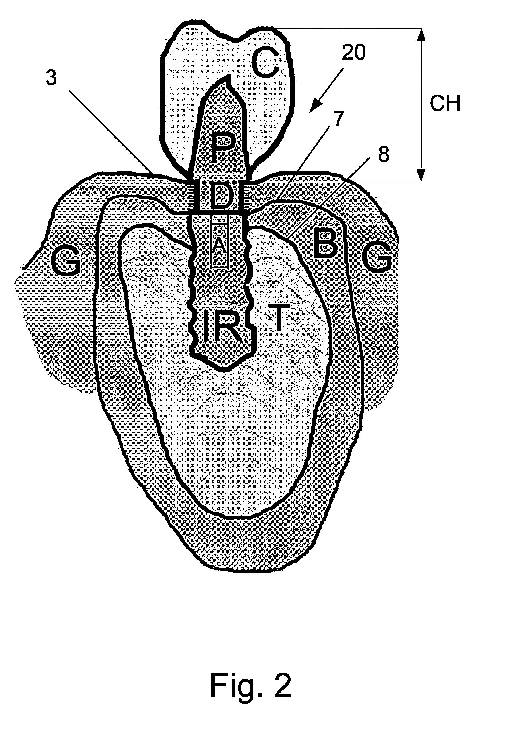 Device and Method for Gingival Attachment Associated with Endosseous Implants