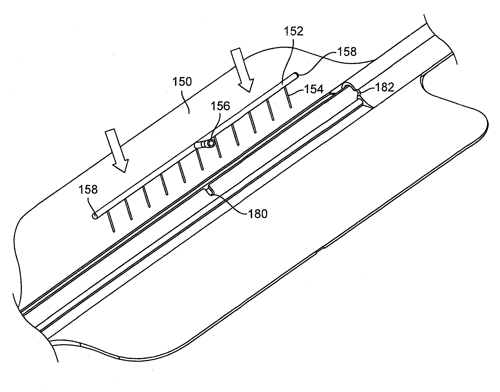 Rapid closing surgical closure device