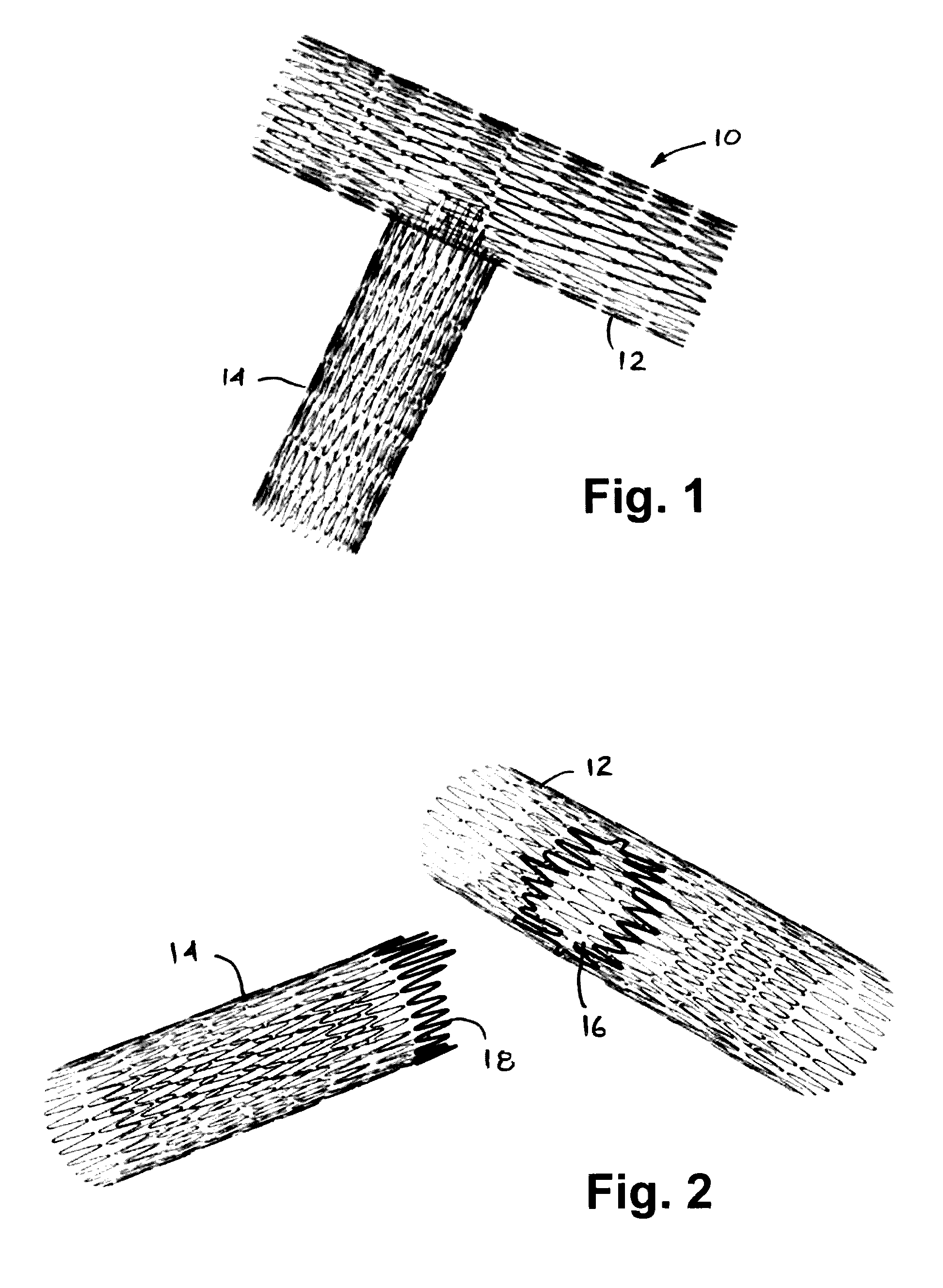 Stent system, deployment apparatus and method for bifurcated lesion