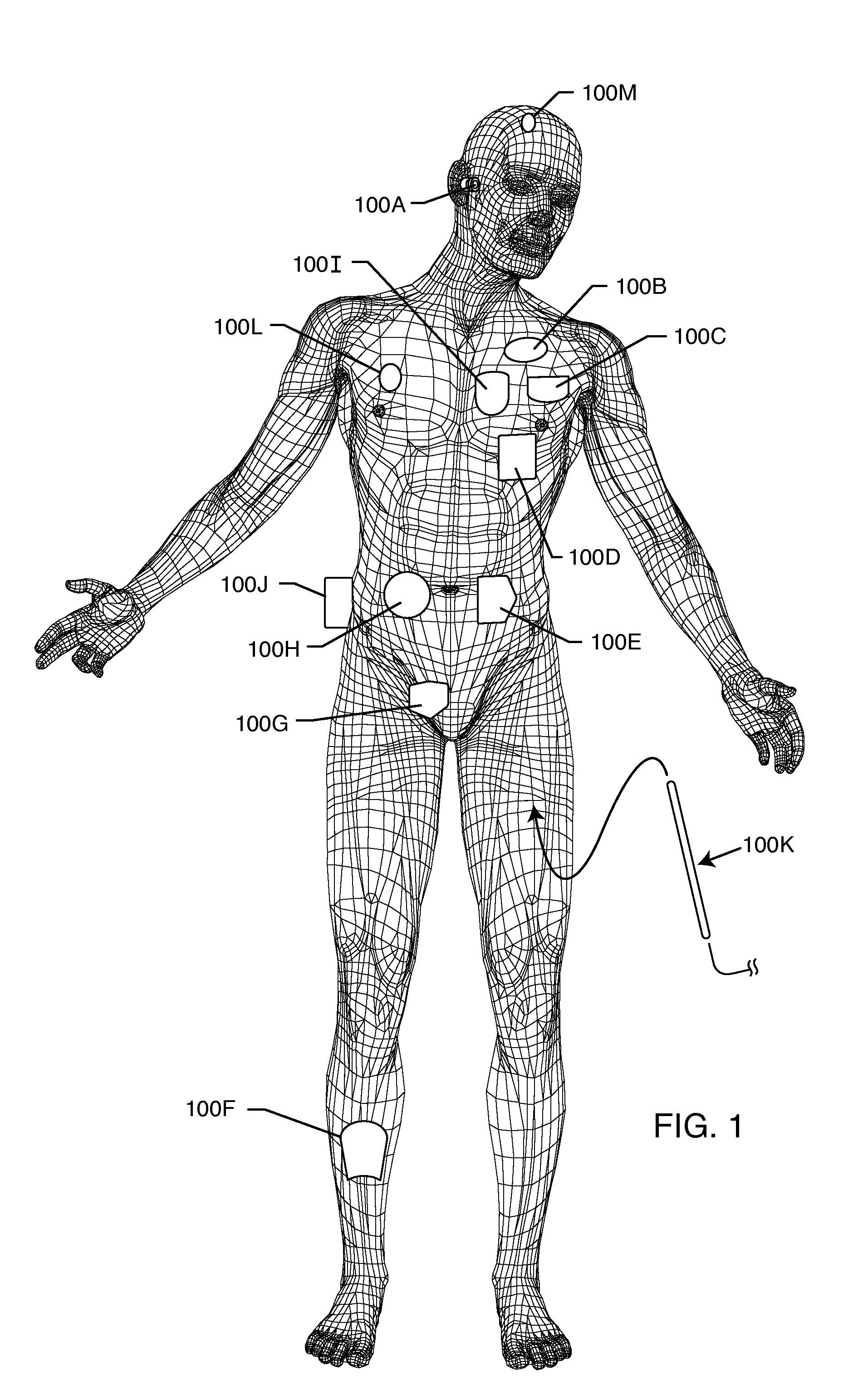 Multiplexer for selection of an MRI compatible band stop filter or switch placed in series with a particular therapy electrode of an active implantable medical device