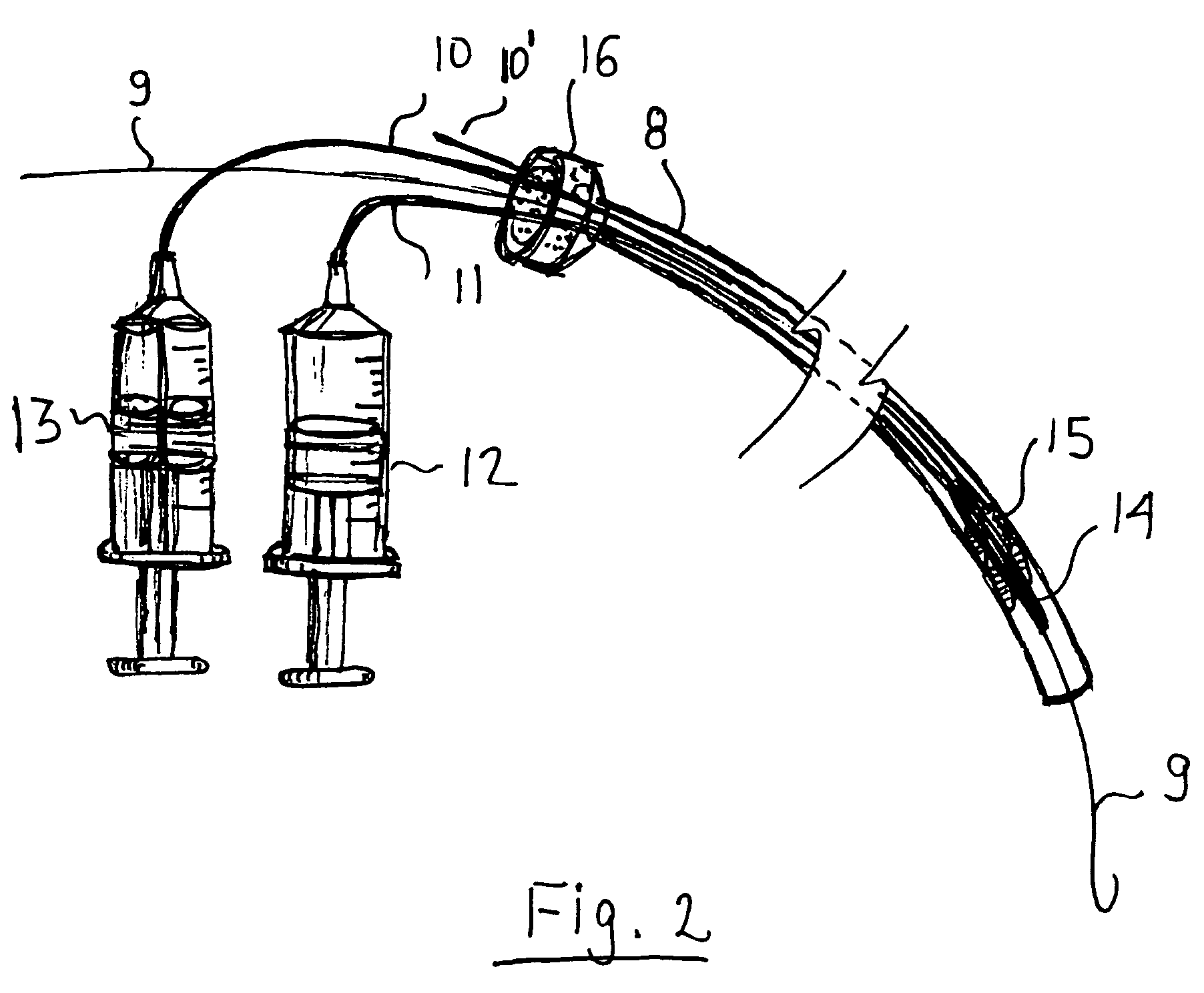 Inflatable artificial valve