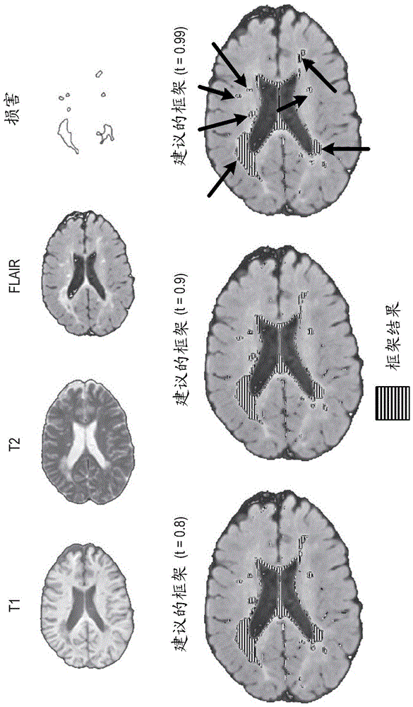 Framework for Abnormality Detection in Multi-Contrast Brain Magnetic Resonance Data