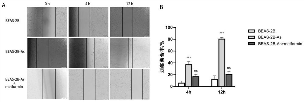 Application of metformin in preparation of medicine for preventing arsenic-induced lung cancer