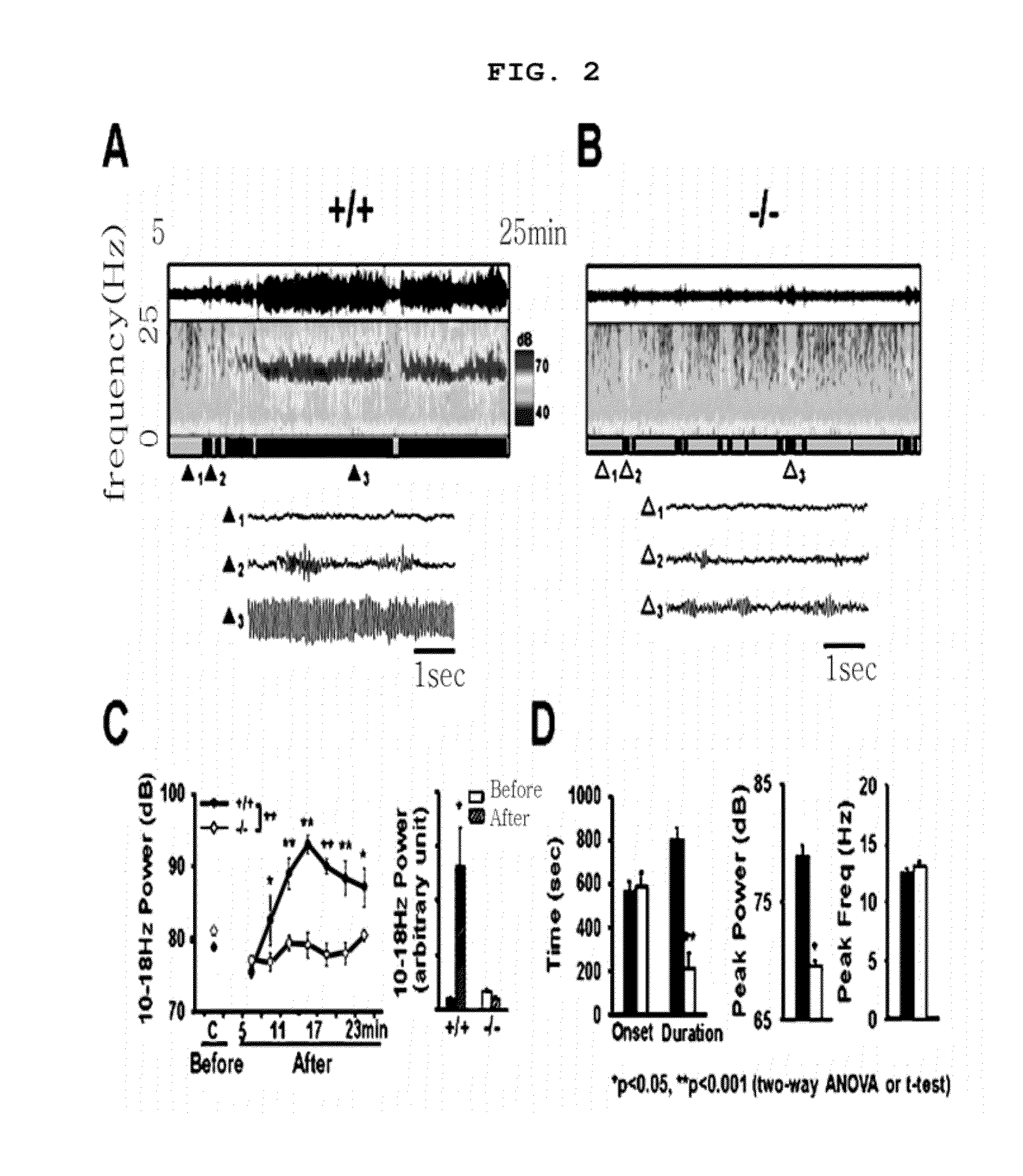 METHOD FOR THE PREVENTION AND TREATMENT OF ESSENTIAL TREMOR BY REGULATING alpha1G T-TYPE CALCIUM CHANNEL OR BY T-TYPE CALCIUM CHANNEL BLOCKERS