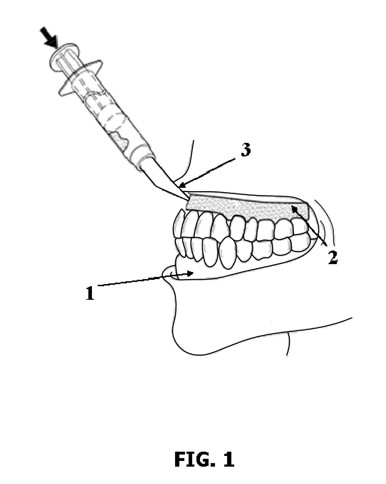 Composition for dental barrier comprising at least one monomer, at least one polymerization initiating system, and at least one indicator enabling the polymerization reaction to be monitored