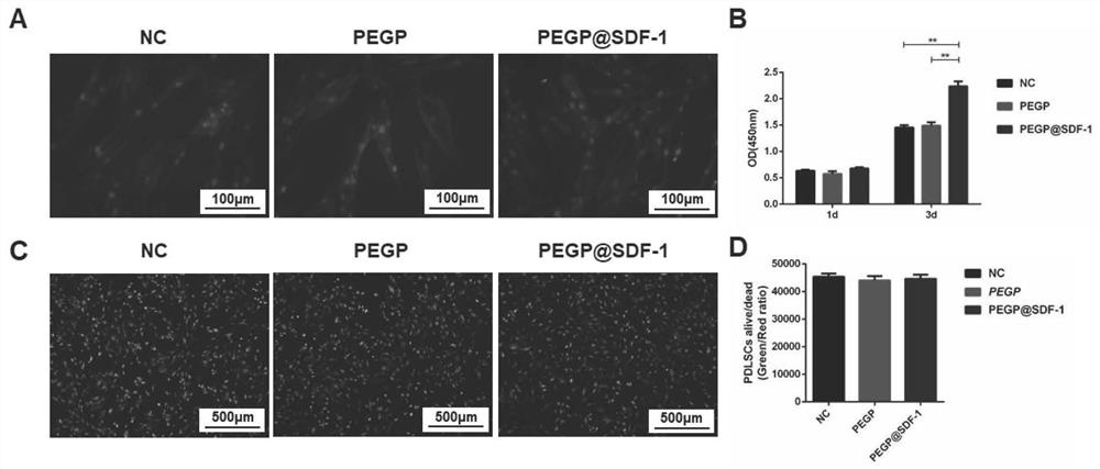 A dual-functional material targeting antibacterial and in situ promoting bone formation and its preparation method and application