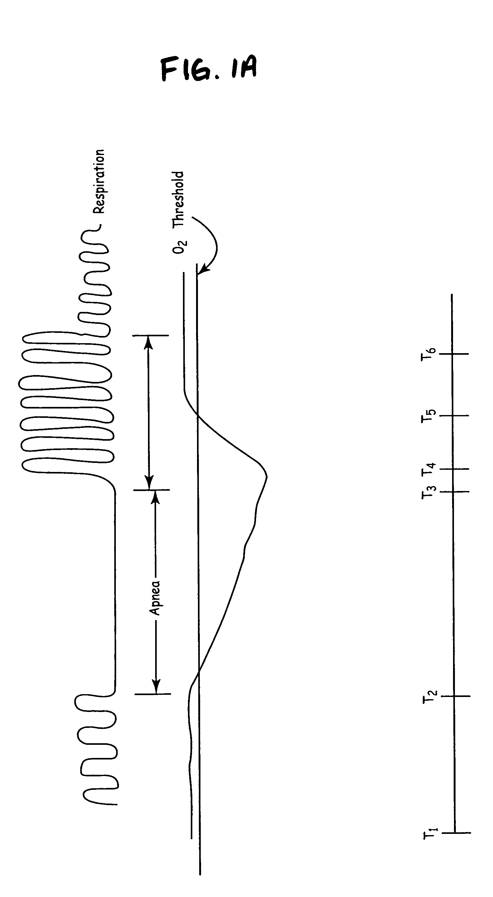 Implantable medical device with circulation delay measurement and therapy control