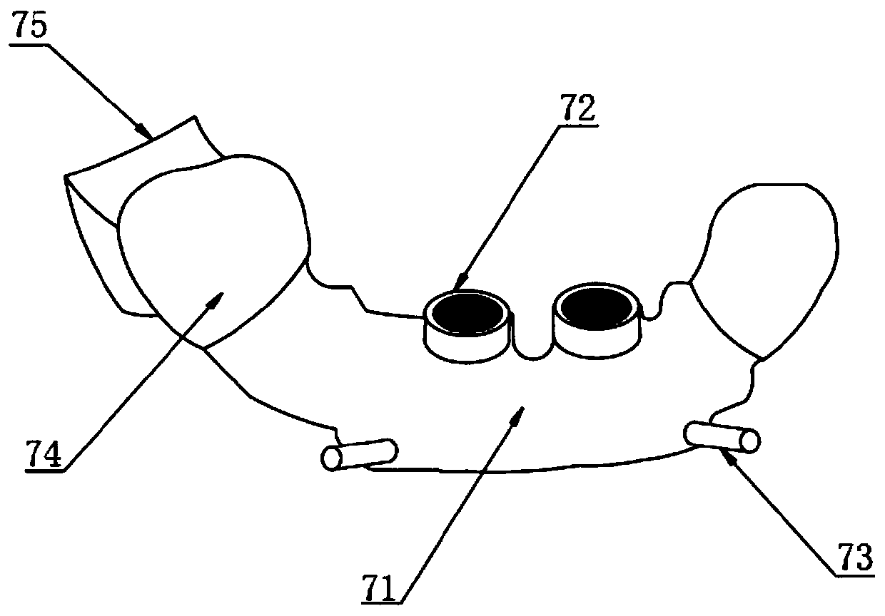 Digital 3D implanting guide plate manufacturing method and system thereof