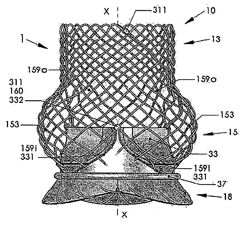Artificial Heart Valve Stent and Weaving Method Thereof