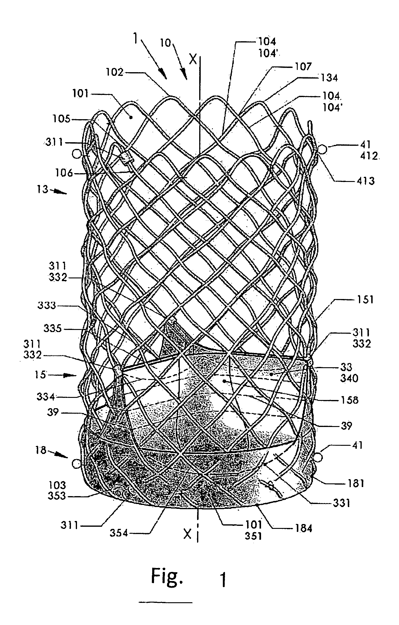 Artificial Heart Valve Stent and Weaving Method Thereof